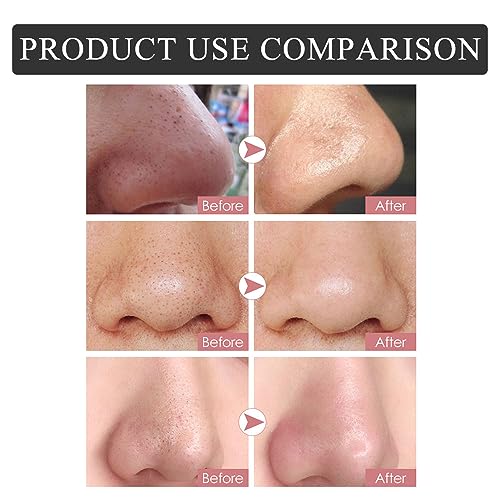 Blackhead Remover Nose Pore Strips for Women & Men, 20 PCS - Product Imagery