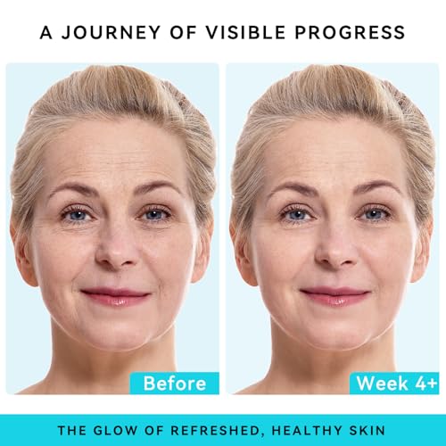 Retinol Face Cream with Collagen & Hyaluronic Acid - Anti Aging - Product Imagery