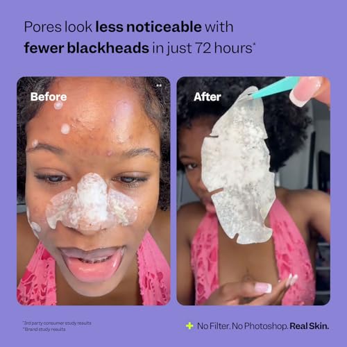 Peach Slices - Nose Pore Patches (7 ct) - Overnight Blackhead - Product Imagery