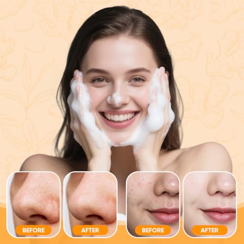 Turmeric Skin Care Set: Turmeric Soap Bar Turmeric Face Wash and - Product Imagery