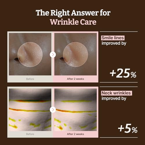 All Advanced PDRN Rejuvenating Mask (1.2 Fl Oz x 4EA) - Product Imagery
