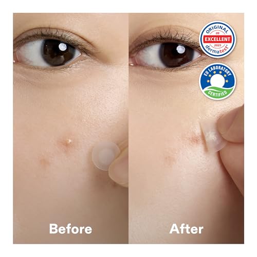Cordiale Centella Pimple Patches with Salicylic & Hyaluronic - Product Imagery
