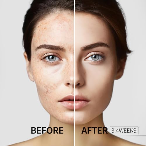 HANYWIL Dark Spot Remover for Face, Vitamin C Serum, Dark Spot - Product Imagery