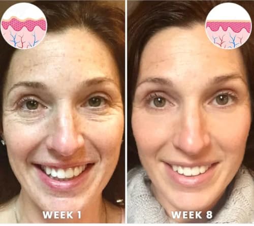 Squalane and Vitamin C Rose Serum. Anti Aging Anti Wrinkle - Product Imagery