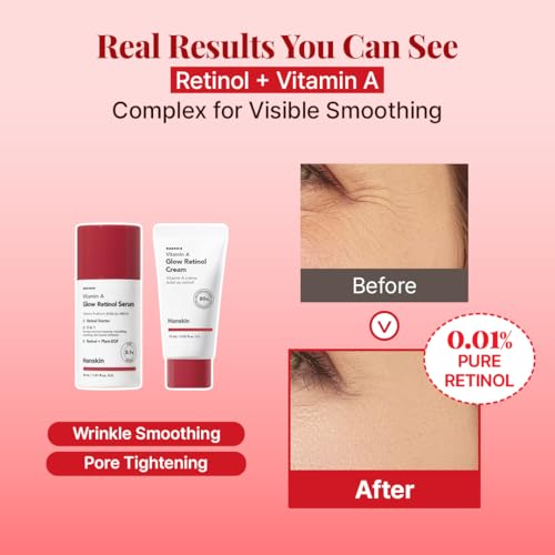 Hanskin Youth Energy On The Go Kit, Retinol & AHA Skincare Set, - Product Imagery