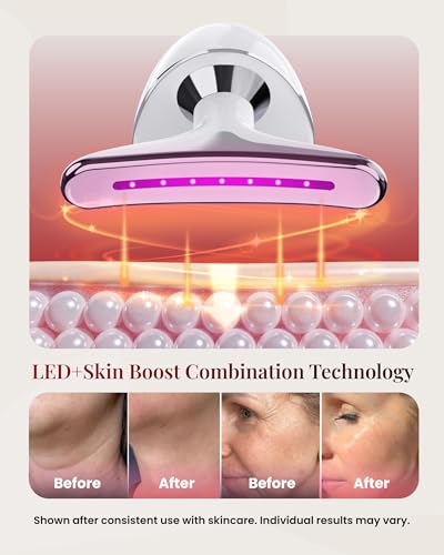 Face Massager Tool with 7 Color LED Light, Ion & Vibration & - Product Imagery