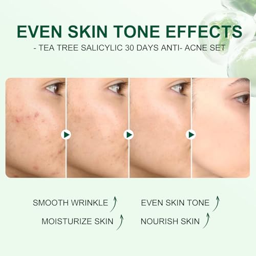Tea Tree Salicylic Acid Facial Skin Care Set, Acne Treatment - Product Imagery