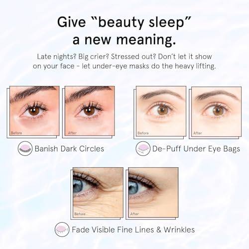 grace & stella Retinol Under Eye Patches for Puffy Eyes - Product Imagery