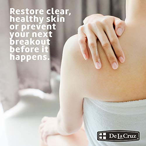 De La Cruz 10% Sulfur Ointment Travel Size - Cystic Acne - Product Imagery