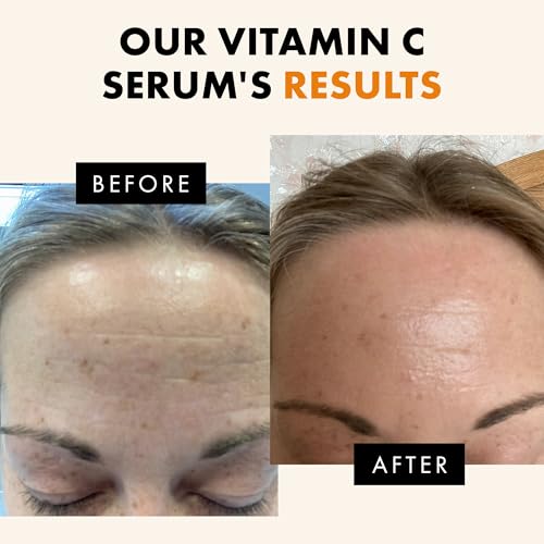 Eclat Skincare Vitamin C Serum - Skin Care for Dark Spots, - Product Imagery