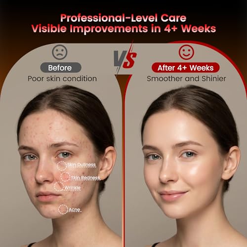 Wireless Red Light Therapy Mask for Face, Anti-Wrinkle & Acne - Product Imagery