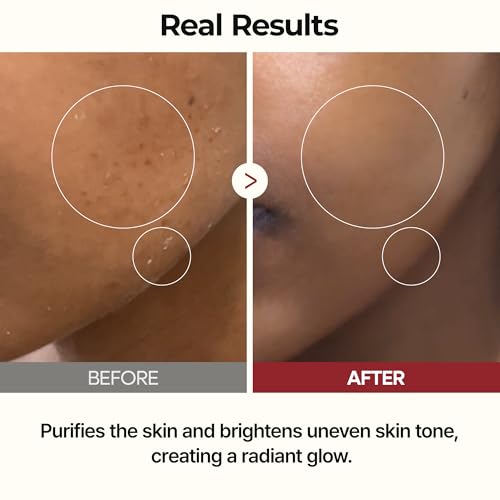 n Peel Shot Glow Rice Toner with Rice Extract & Ceramides, - Product Imagery
