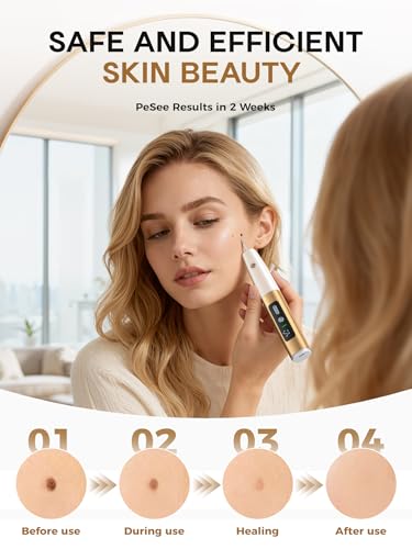 USB Rechargeable Skin Tag Remover Pen - Product Imagery