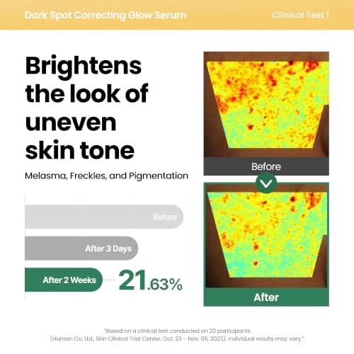 AXIS-Y Dark Spot Correcting Glow Serum - 5% Niacinamide Dark Spot - Product Imagery