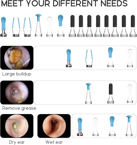 Bebird 14pcs Original Ear Camera Replacement Tips for - Product Imagery