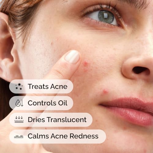 The Ordinary Sulfur 10% Powder-to-Cream Acne Spot Treatment - Product Imagery