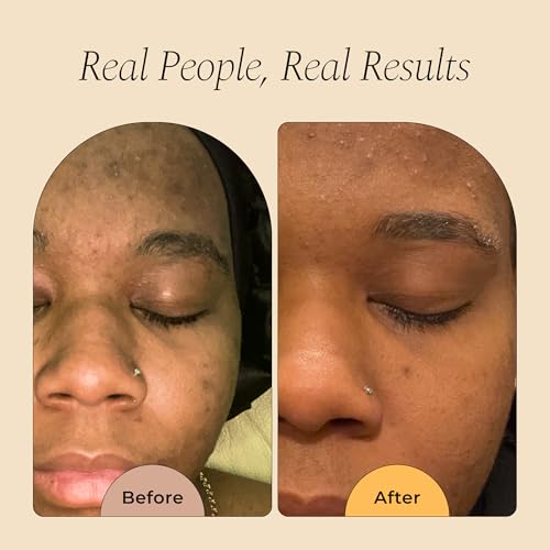 Glo Melanin Turmeric Brightening Soap with Vitamin C, Alpha - Product Imagery