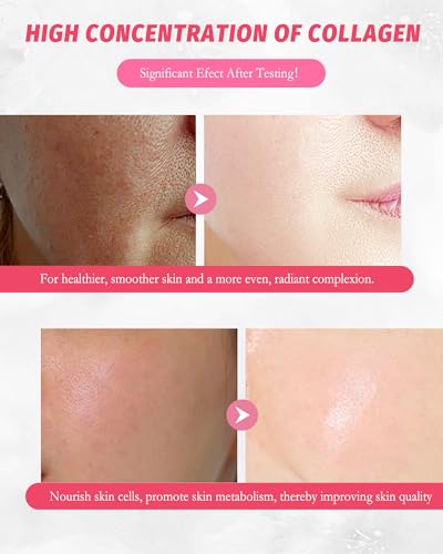 Facial Mask Skincare Set,10Pcs Sakura Collagen Skin Care Sheet - Product Imagery