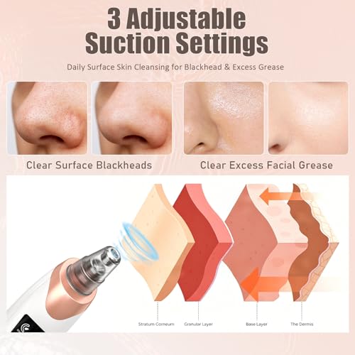 Blackhead Remover Pore Vacuum,Facial Pore Cleaner Blackhead - Product Imagery