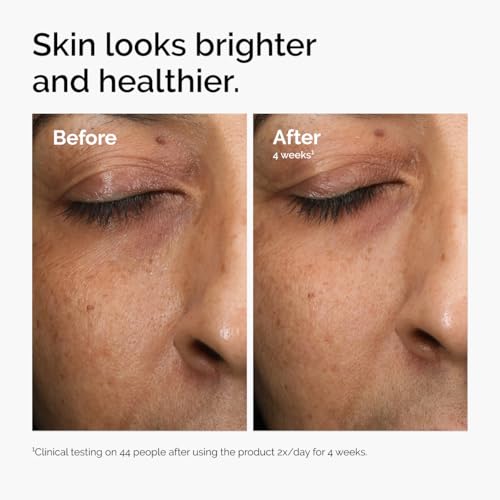 The Ordinary Multi-Antioxidant Radiance Serum, Vitamin C Serum - Product Imagery