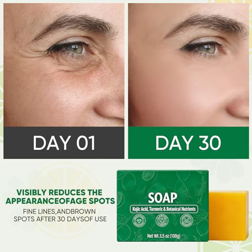 2Pcs Stemsoul Soap,Superfood Stemsoul Soaps,StemSoul Turmeric - Product Imagery