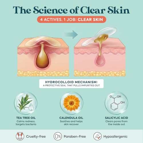 272 CT Large Pimple Patches for Face - 10 Sizes Variety Pack Zit - Product Imagery