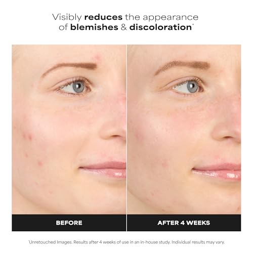 Paula's Choice BOOST 10% Azelaic Acid Booster Cream Gel Serum - Product Imagery