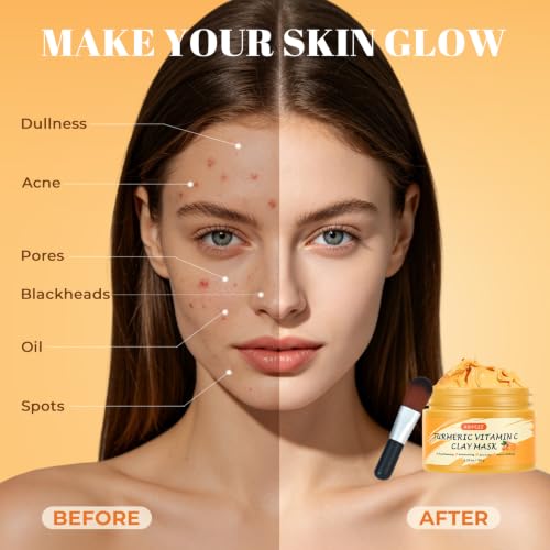 Turmeric Vitamin C Clay Mask with Kaolin Clay, Deep Cleansing - Product Imagery
