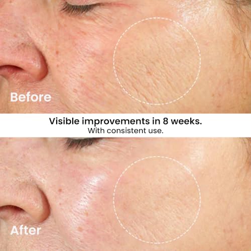 Kleem Retinol Face Moisturizer - Anti-Aging Night Firming Cream - Product Imagery