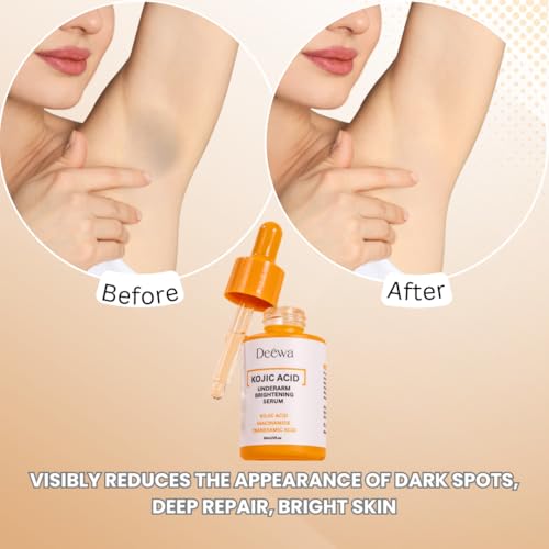 Kojic Underarm Brightening Serum with Niacinamide for Elbows, - Product Imagery