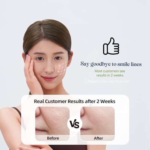 Smile Line Patches (12 pcs), Nasolabial Folds & Laugh Line - Product Imagery