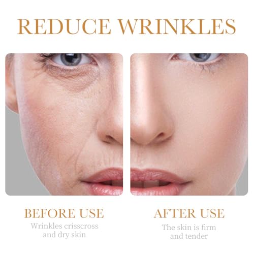 Collagen Skin Care Set, 6Pcs Face Care Sets for Older Women, - Product Imagery