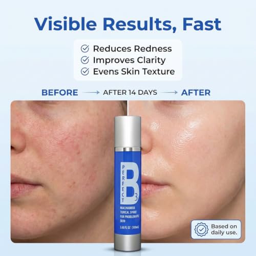 Niacinamide Spray for Face, Vitamin B3 Face Mist 3.6oz - Product Imagery