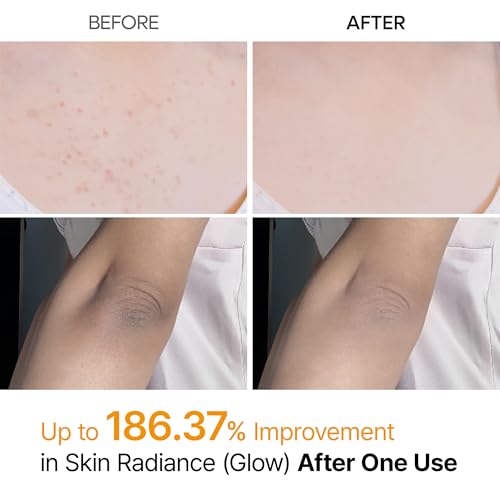 n Peel Shot Kojic Acid Turmeric Body Exfoliator Spray 6.76 fl.oz - Product Imagery