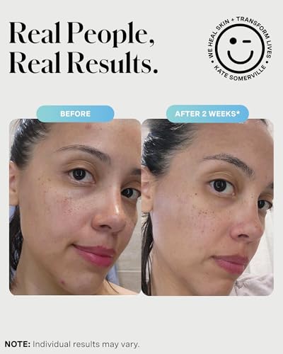 Kate Somerville EradiKate 3% Sulfur Daily Foaming Cleanser, 4 Fl - Product Imagery
