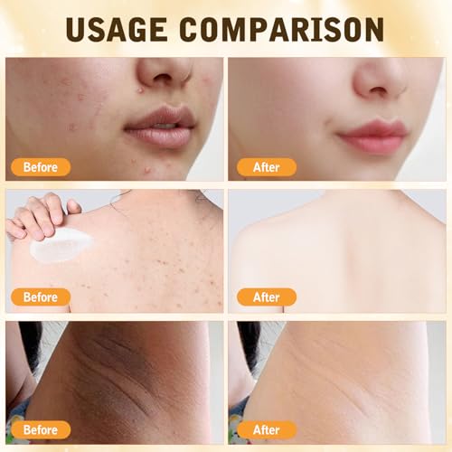 2PCS Bee Venom Comprehensive Cream, Bee Venom Skin Treatment - Product Imagery