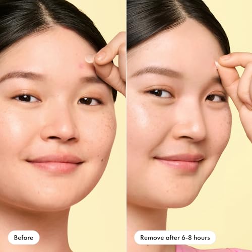 Hero Cosmetics Mighty Patch Mini Invisible+ Acne Pimple Patches, - Product Imagery