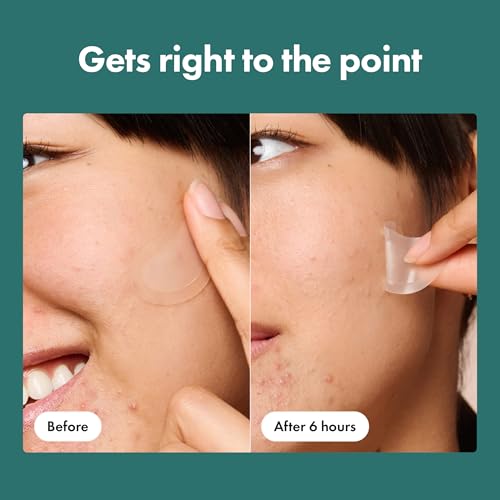 Mighty Patch Hero Cosmetics Micropoint XL Acne Pimple Patches, 6 - Product Imagery