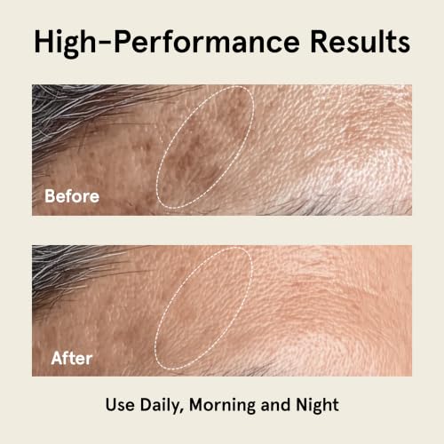 JAXON LANE Super Serum Korean Face Serum for Men, 1 Pack - Product Imagery