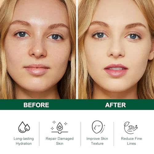 Tea Tree Salicylic Acid Facial Skin Care Set, Acne Treatment - Product Imagery