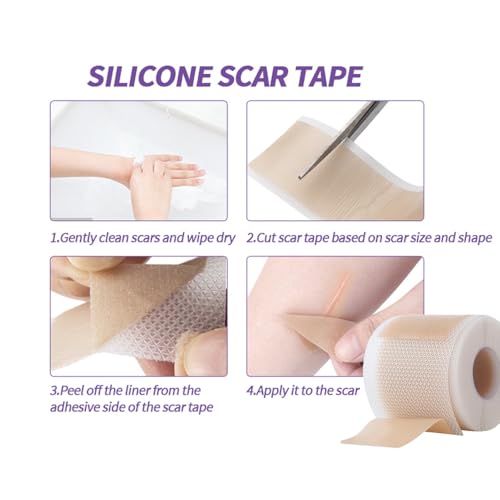 Medical Grade Silicone Scar Sheets, (1.6" x 60" Scar Roll-1.5M) - Product Imagery