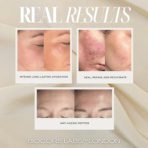 Advanced 3 IN 1 SNAIL MUCIN SUPER SERUM infused with FACELIFT - Product Imagery