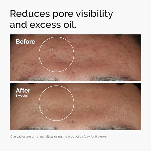 The Ordinary Serum Favorites Set – Hyaluronic Acid 2% + B5, - Product Imagery