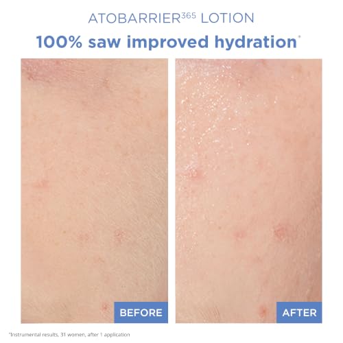 AESTURA ATOBARRIER365 Lightweight Korean Face Moisturizer with - Product Imagery