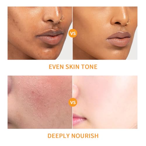 Baorder 6PCS Hydrating Skin Care Set with Vitamin C,Face Care - Product Imagery