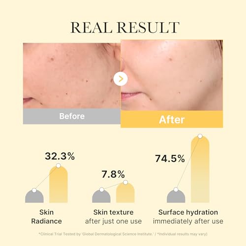medicube Jelly Gel Mask with Brightening Kojic Acid Turmeric, 4EA - Product Imagery
