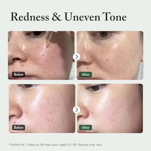 AROMATICA Azelaic Acid 10% Serum 1.01 fl oz - Product Imagery