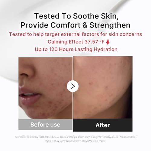 medicube Clarifying Pad & Soothing Cream Duo - Succinic Acid Pad - Product Imagery
