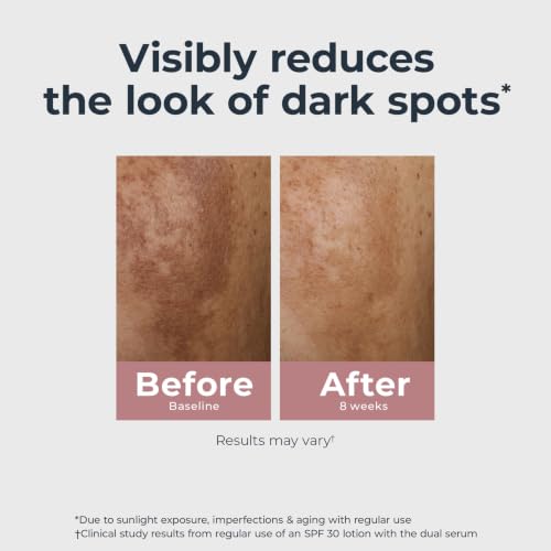 Eucerin Radiant Tone Dual Serum Dark Spot Corrector, Dark Spot - Product Imagery
