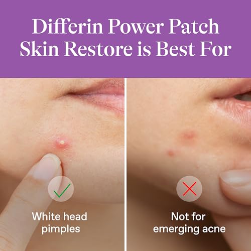 Differin Power Pimple Patches, Hydrocolloid Acne Treatment, 23ct - Product Imagery